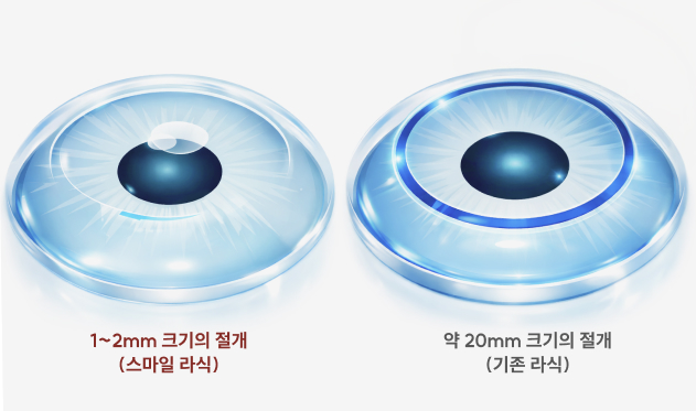 성장기 우리 아이의 시력 보호