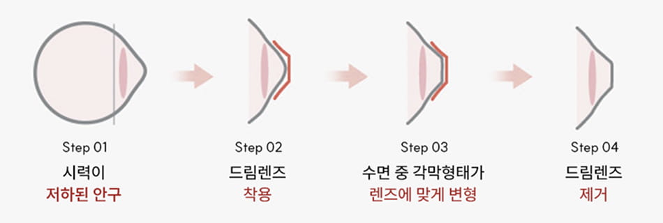 드림렌즈 원리